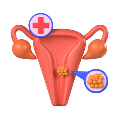 Cervical Cancer 3D Model 3D Graphic