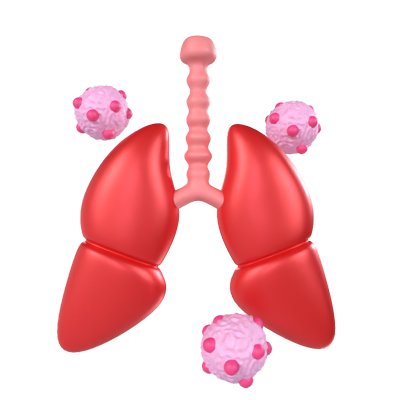 Lung Cancer 3D Model 3D Graphic