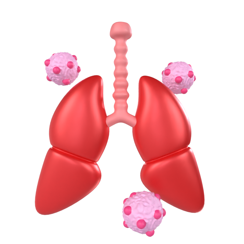 Lung Cancer 3D Model 3D Graphic