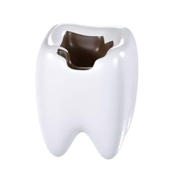 Tooth Decay 3d model--007c358c-5f22-4e20-90f7-7dcd0861fe00