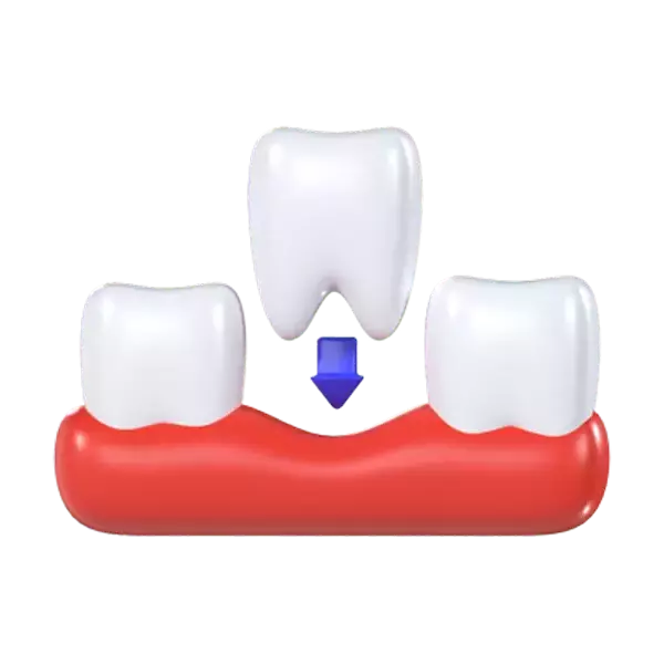 Tooth Filling 3d model--782c8961-927a-4d07-915f-804951e4d17d