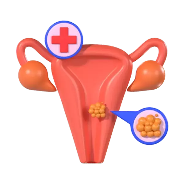 Cervical Cancer 3d model--88cfbf8c-1515-4e3d-bbc3-35a13a119265