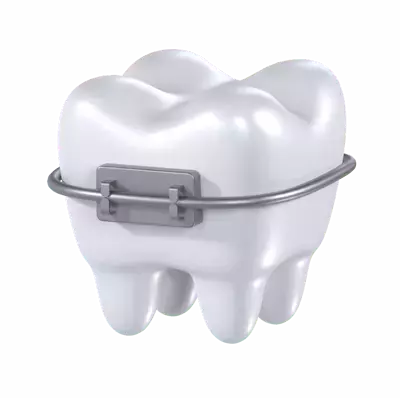 Dental Braces 3d model--531a00da-509f-45aa-ad56-97de113697bb
