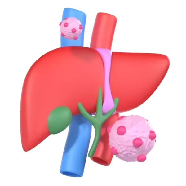 Liver Cancer 3D Graphic