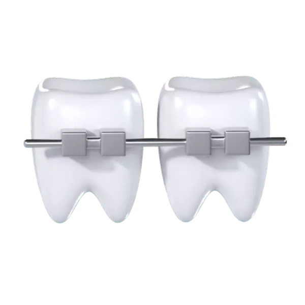 Teeth Brackets 3d model--7a981029-28c8-4181-932c-725e57affc8e